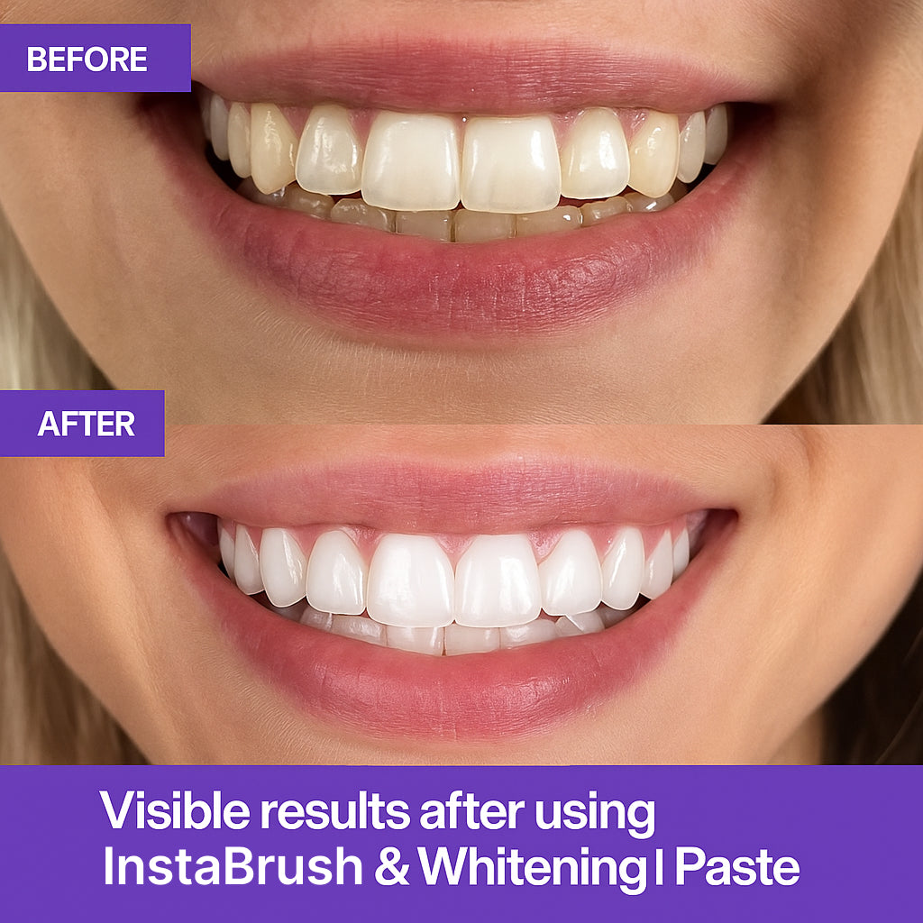 AutoBrush Whitening Toothbrush